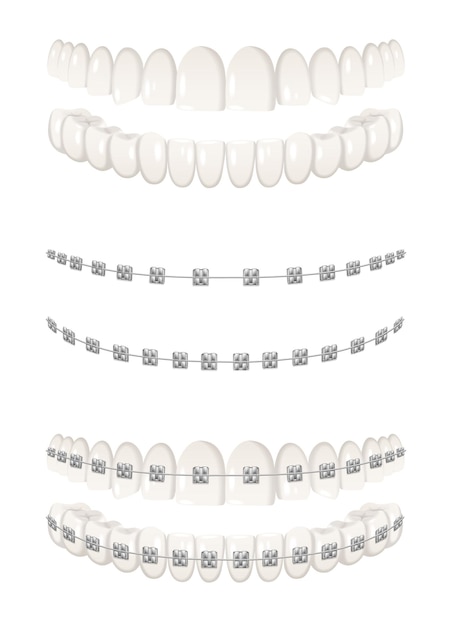 Discover the Essential Benefits of a Denver Orthodontist