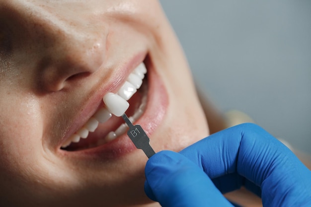 Discover the Essential Facts About All-On-4 Dental Implants