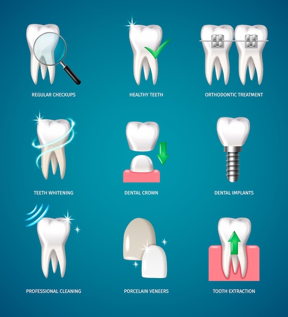 Discover the Secrets of Veneers in Cosmetic Dentistry