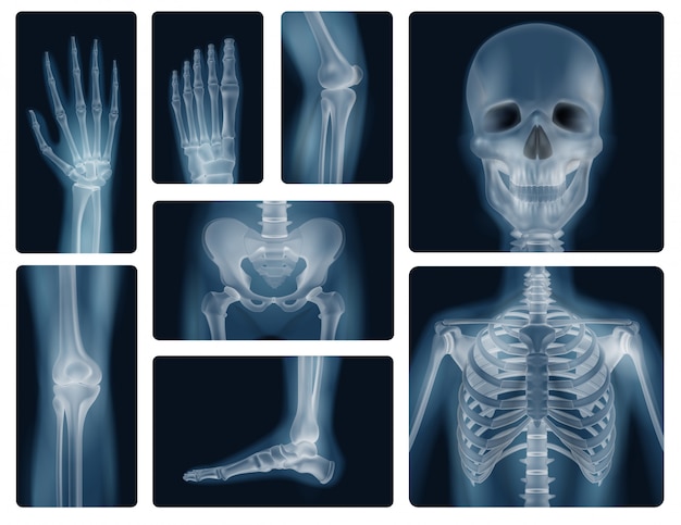 Essential Insights: 4 Key Considerations Before Your Next X-Ray Exam