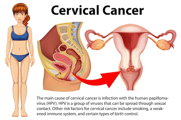 India: The Ultimate Destination for Successful Cervical Spine Surgery