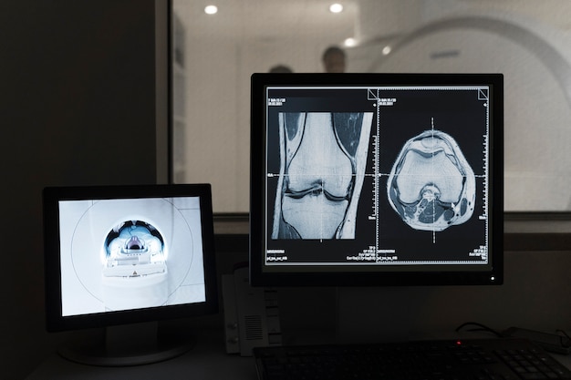 Six Critical Health Conditions That X-Rays Can Uncover