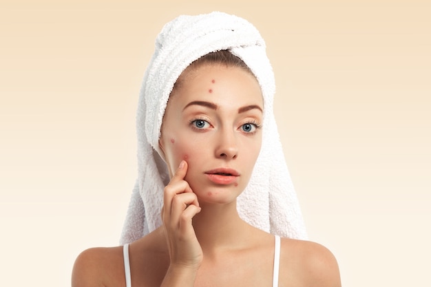 Top Strategies to Banish Acne Scars for Good